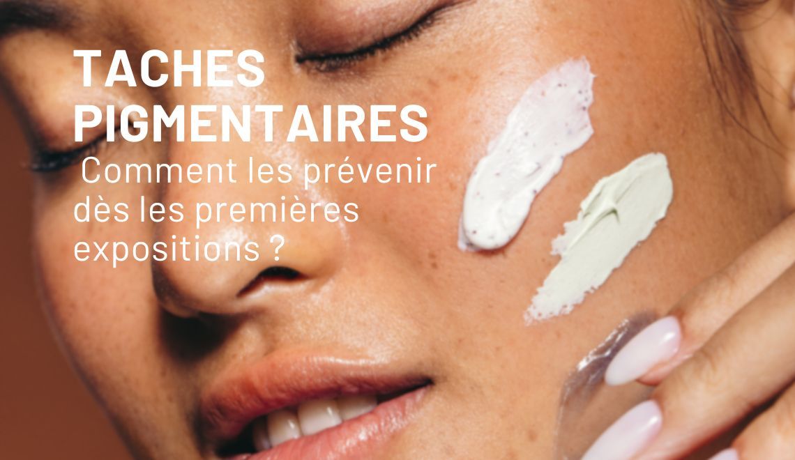 Taches pigmentaires : comment les prévenir dès les premières expositions ?