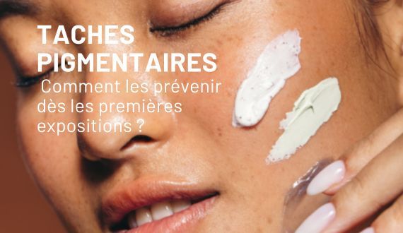 Taches pigmentaires : comment les prévenir dès les premières expositions ?