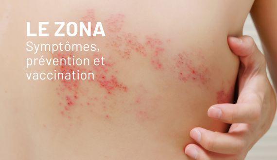 Le zona : symptômes, prévention et vaccination