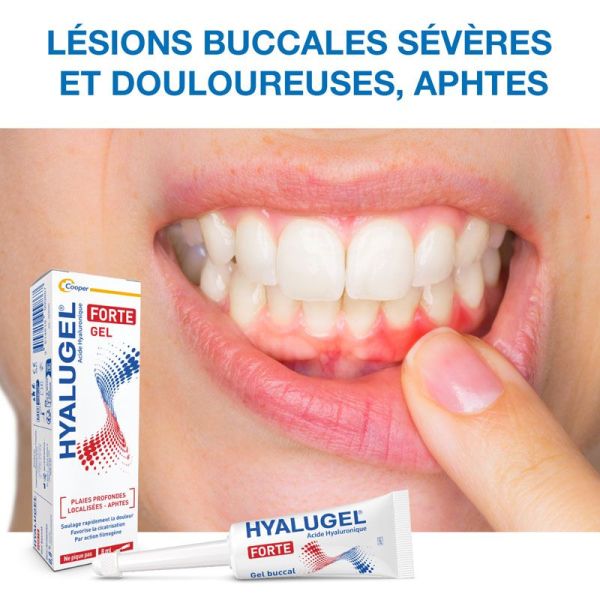 Cooper Hyalugel Forte Gel plaies profondes localisées, aphtes (8 ml)