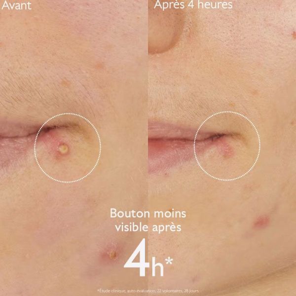 Caudalie Vinopure Stop Boutons Salicylique (15 ml)