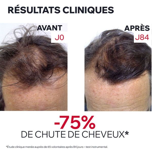 Uriage AP Hair Sérum anti-chute intensif (100 ml)