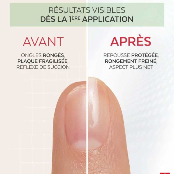 Poderm Professionnal Nail Corrector Vernis Amer aux protéines de pois, anti-rongement (8 ml)