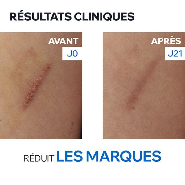 Uriage Bariéderm Cica+ Crème réparatrice marques cicatricielles (100 ml)