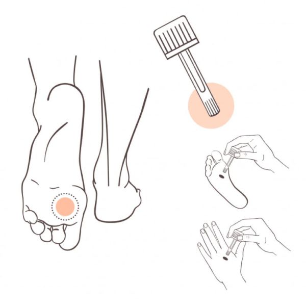 AROMADERM Verrucarom Solution pieds et mains