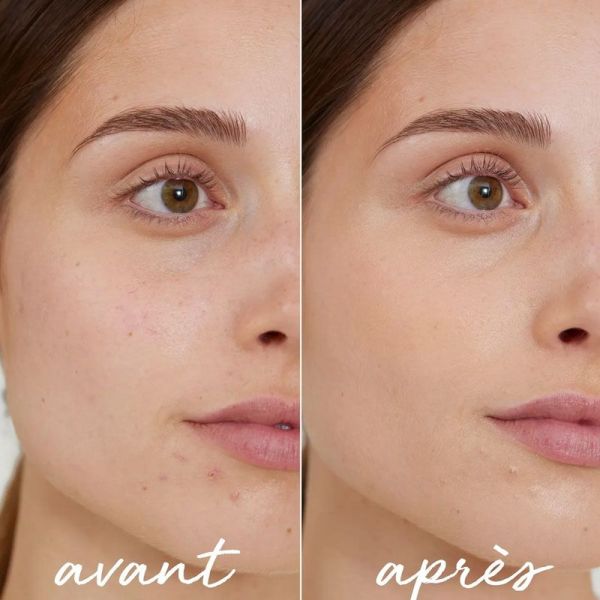 La Rosée Stick Correcteur Teinté anti-imperfections au zinc rechargeable (5,5 g)