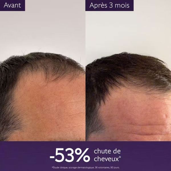 Caudalie Sérum Capillaire Anti-chute (50 ml)