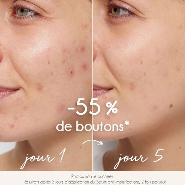 La Rosée Sérum Purifiant Anti-Imperfections au zinc et acides de fruits bio (30 ml)