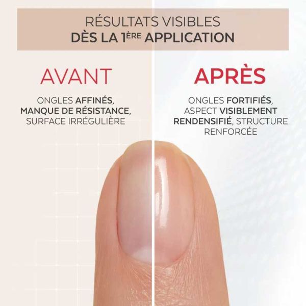 Poderm Professionnal Nail Corrector Vernis Redensifiant à la Kératine (8 ml)
