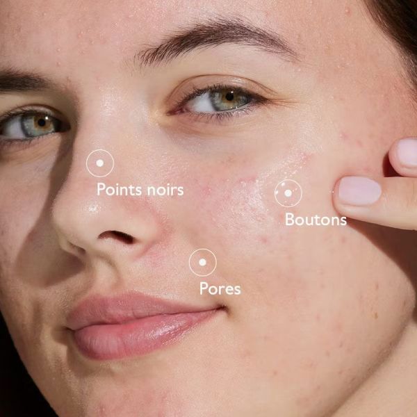 Caudalie Vinopure Sérum à l'Acide Salicylique Anti-imperfections (30 ml)