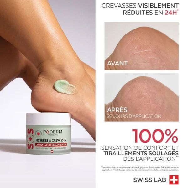 Poderm Onguent Ultra-Réparateur 24h fissures & crevasses (25 g)