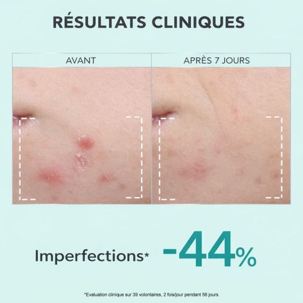 Apivita Just Bee Clear Sérum resurfaçant, anti-iimperfections, anti-marques (30 ml)