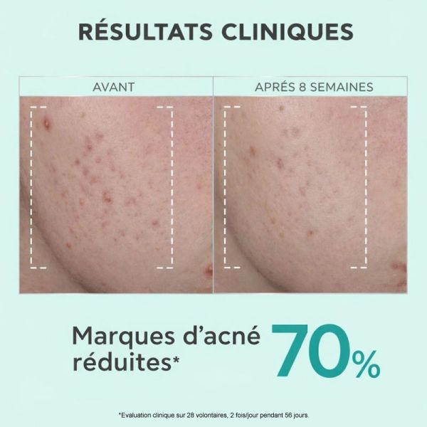 Apivita Just Bee Clear Sérum resurfaçant, anti-iimperfections, anti-marques (30 ml)